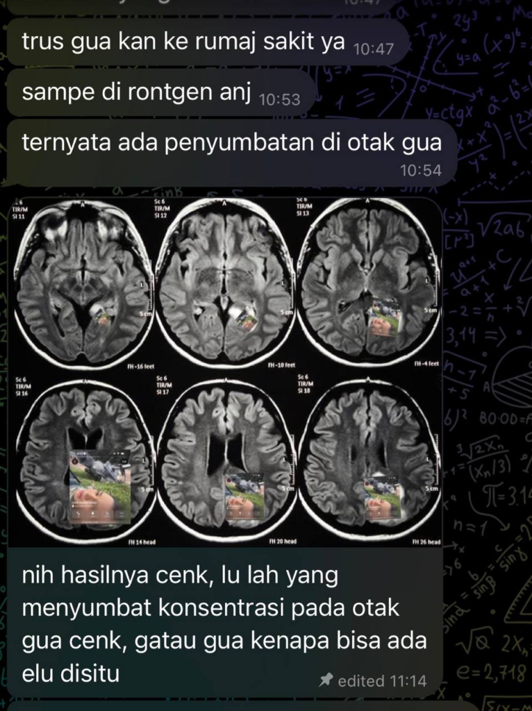 YOUR FIRST PICKUP LINE LOLL HAHAHAH